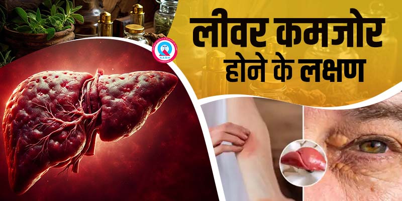लीवर कमजोर होने के लक्षण
